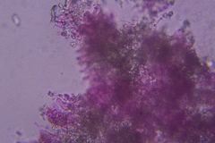 Lyomyces erastii