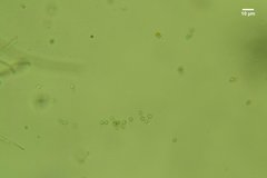 Byssocorticium atrovirens