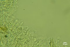 Kneiffiella curvispora