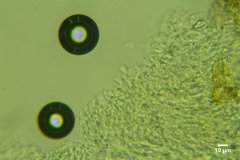 Kneiffiella curvispora