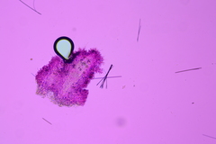 Kneiffiella curvispora