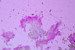 Kneiffiella curvispora