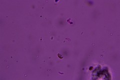 Kneiffiella curvispora
