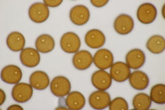 Puccinia picridis-strigosae