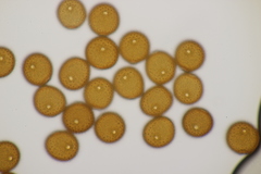 Puccinia picridis-strigosae