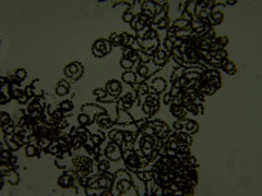 Dolichospermum lemmermannii