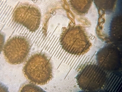 Fossombronia wondraczekii