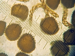Fossombronia wondraczekii