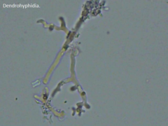 Corticium roseocarneum