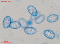 Scutellinia nigrohirtula