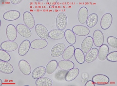Scutellinia nigrohirtula