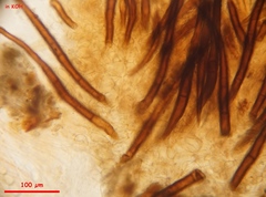 Scutellinia nigrohirtula