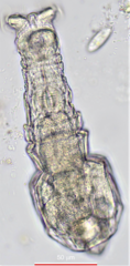 Macrotrachela ehrenbergii