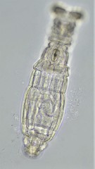 Macrotrachela ehrenbergii
