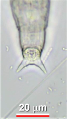 Macrotrachela ehrenbergii