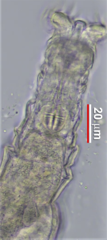 Macrotrachela ehrenbergii