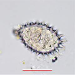 Macrotrachela ehrenbergii