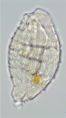 Macrotrachela multispinosa brevispinosa