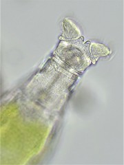 Macrotrachela musculosa