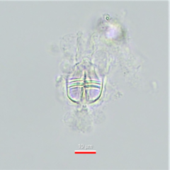 Macrotrachela musculosa