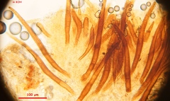 Scutellinia nigrohirtula