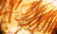 Scutellinia nigrohirtula