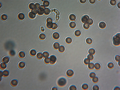 Microbotryum violaceoverrucosum