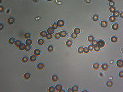 Microbotryum violaceoverrucosum