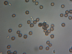 Microbotryum violaceoverrucosum