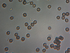 Microbotryum violaceoverrucosum