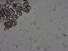 Dolichospermum lemmermannii