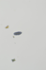 Rhizocarpon geminatum