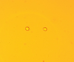 Clavulina castaneipes