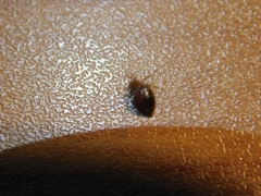 Cimex lectularius