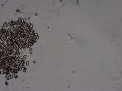 Dolichospermum lemmermannii