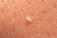 Cacopsylla pulchella