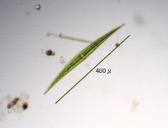Closterium ralfsii