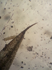 Philonotis pyriformis