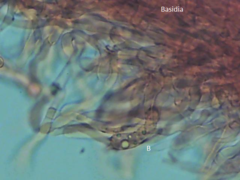 Boletopsis subsquamosa