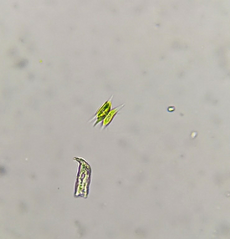 Tetradesmus wisconsinensis