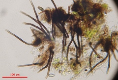 Strossmayeria basitricha