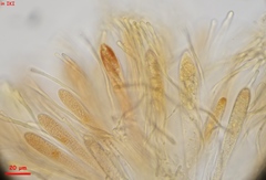 Strossmayeria basitricha