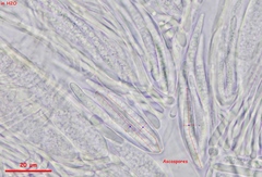 Strossmayeria basitricha