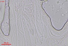 Strossmayeria basitricha