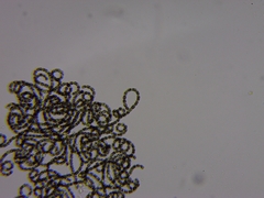 Dolichospermum lemmermannii