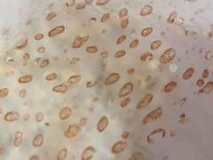 Chrysaora chesapeakei