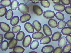 Botryobasidium conspersum