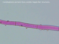 Botryobasidium conspersum