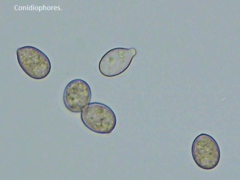 Botryobasidium conspersum