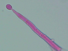 Botryobasidium conspersum